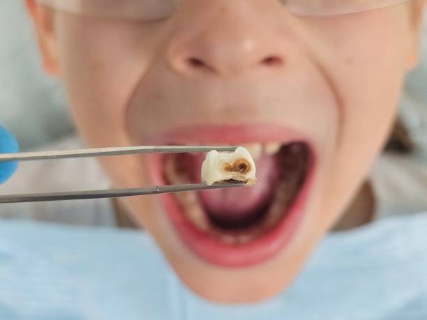 Best Urgent Tooth Repair  in Kingsburg, CA